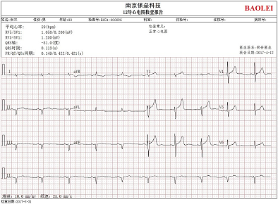 美观可定制的报告样式