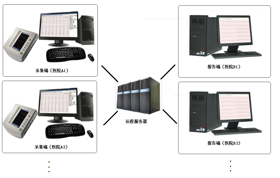 医联体心电网络